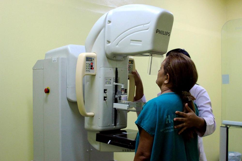 Moradora questiona falta de aparelho e agendamentos suspensos para mamografias em Parintins